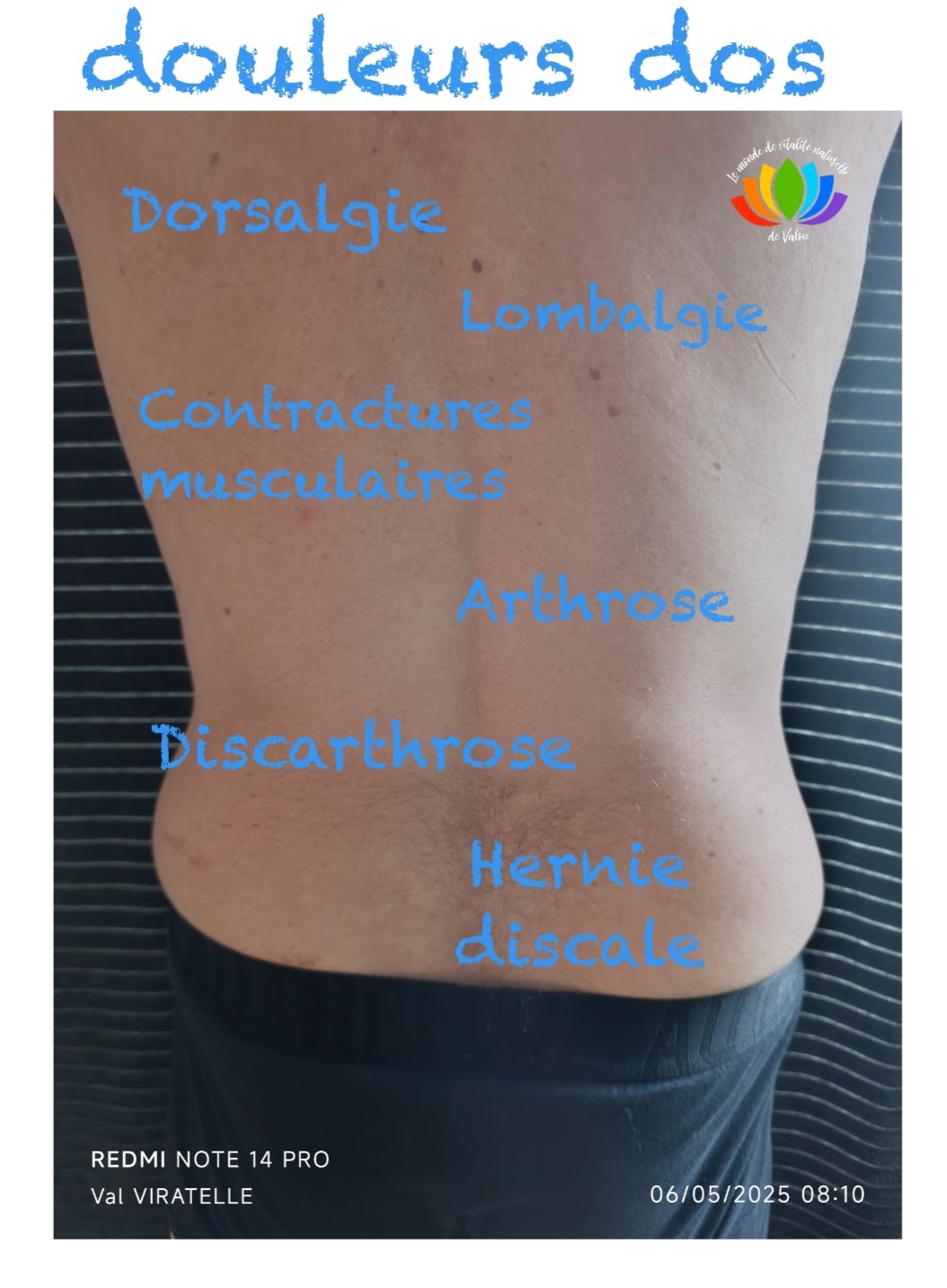 Une photo montrant le dos d'un homme pour illustrer des zones de douleurs