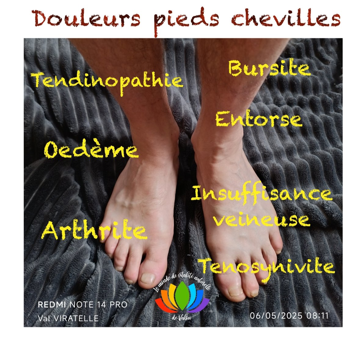 Une photo montrant les pieds d'un homme pour illustrer des zones de douleurs