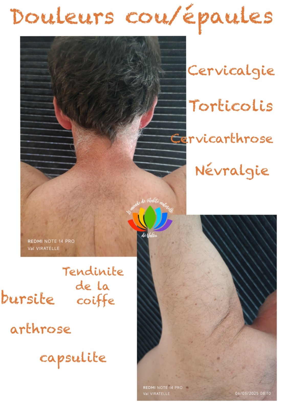 Une photo montrant le dos et les épaules d'un homme pour illustrer des zones de douleurs